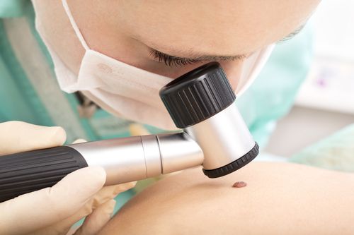 Pembrolizumab: parere favorevole del CHMP dell'EMA per il trattamento del melanoma avanzato 