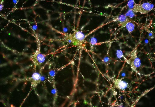 La proteina C4 (in verde) è localizzata a livello delle sinapsi (in rosso e bianco) di neuroni umani in coltura (blu) (credits: Broad Institute,  image courtesy of Heather de Rivera (McCarroll lab)). 