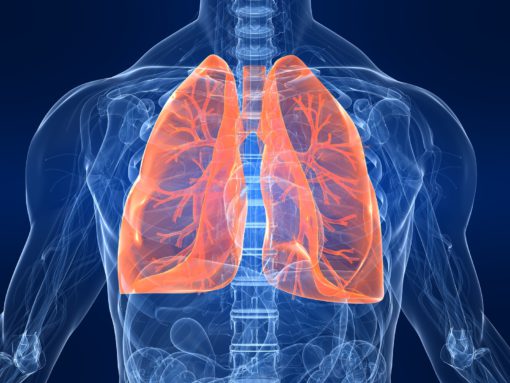 fibrosi polmonare idiopatica