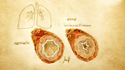 asma croncocostrizione