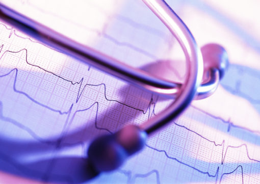 Il sistema CardioMEMS HF per il monitoraggio della pressione arteriosa polmonare e per la gestione della terapia nei pazienti con scompenso cardiaco, è stato inserito nelle linee guida della ESC