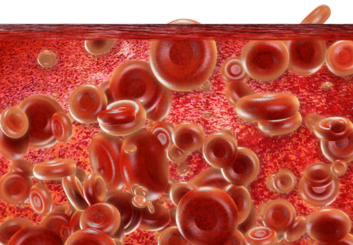 Emicizumab per il trattamento dell’emofilia A in soggetti con inibitori del fattore VIII ha ridotto il numero di sanguinamenti