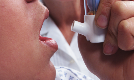 La nuova indicazione di tiotropio Respimat per l'asma in Italia lo rende l'unico LAMA indicato come trattamento addizionale in pazienti asmatici adulti